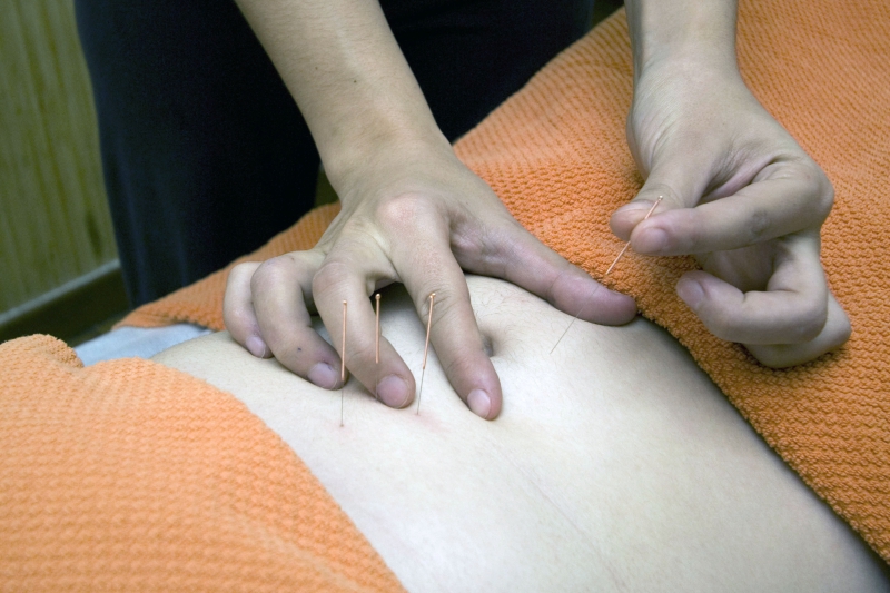 osteopathe-CLAVIERS-min_acupuncture-4175625